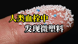 震惊！人类血栓中首次发现微塑料！