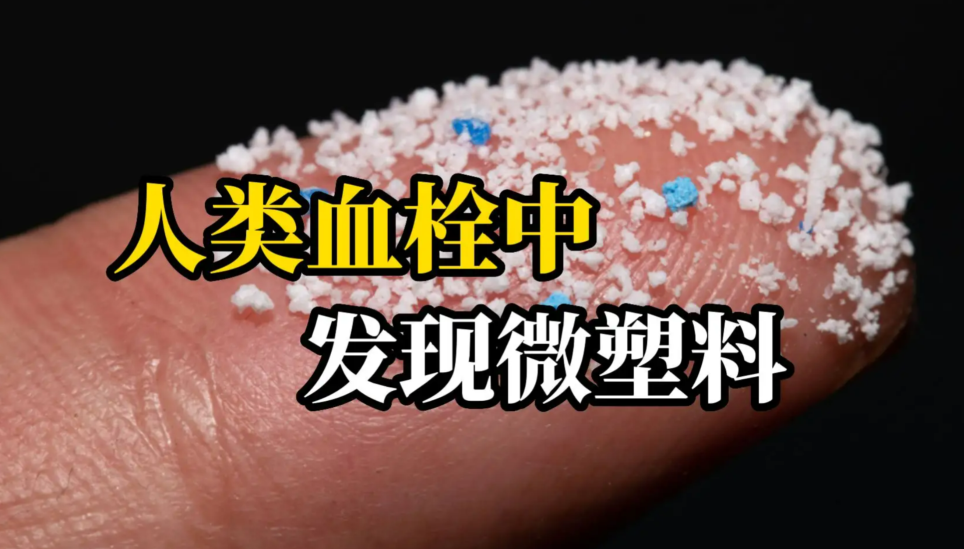 震惊！人类血栓中首次发现微塑料！